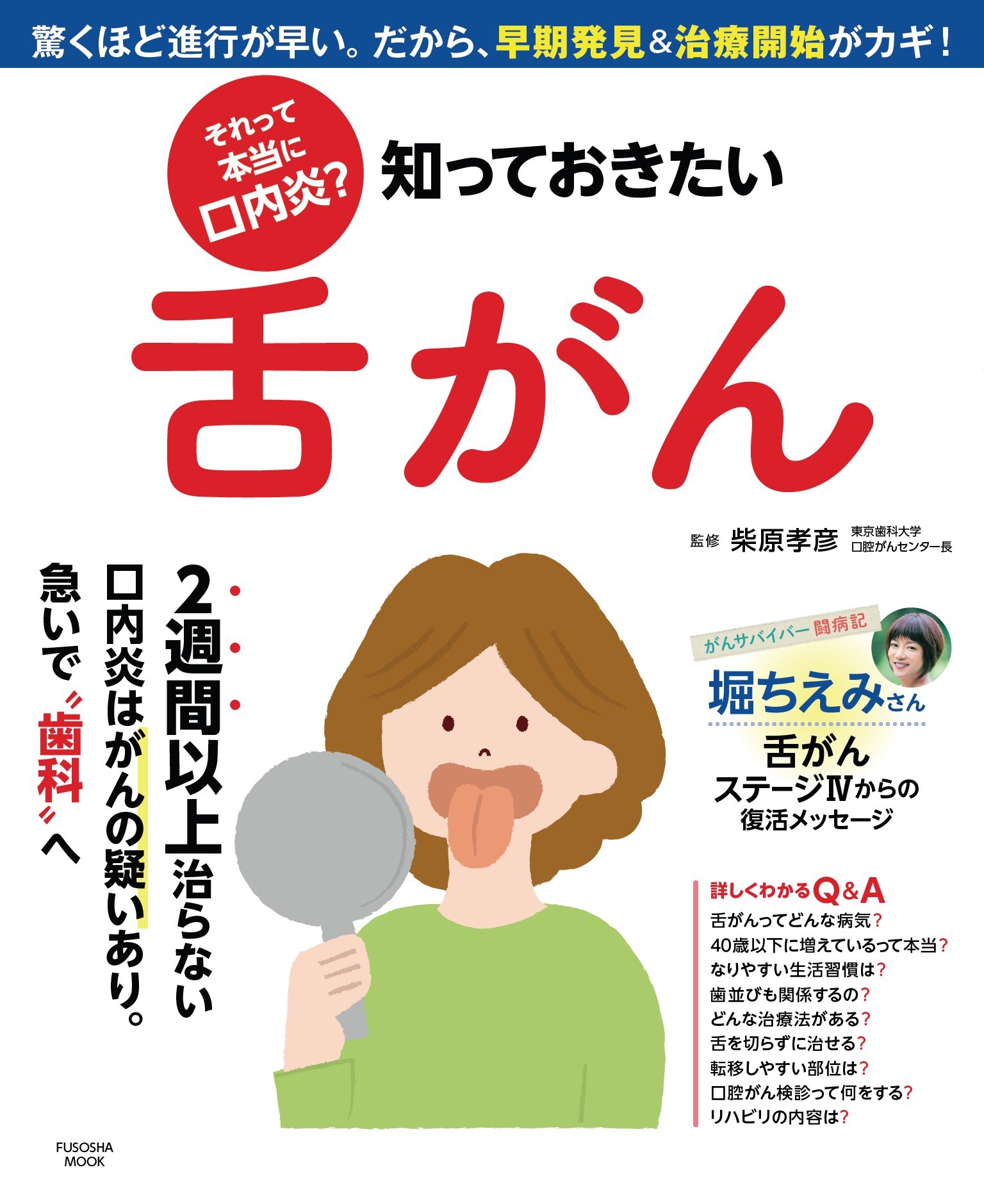それって本当に口内炎? 知っておきたい舌がん